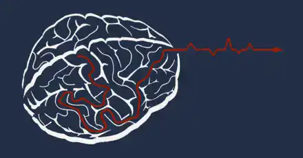 IQ Test 2017